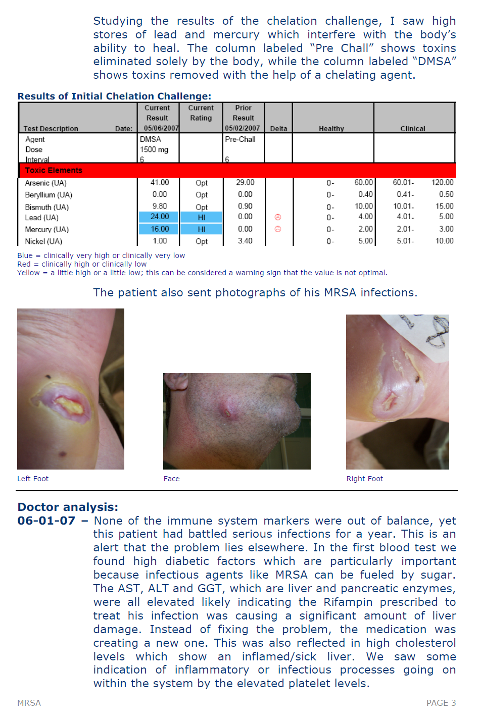 Mrsa3 